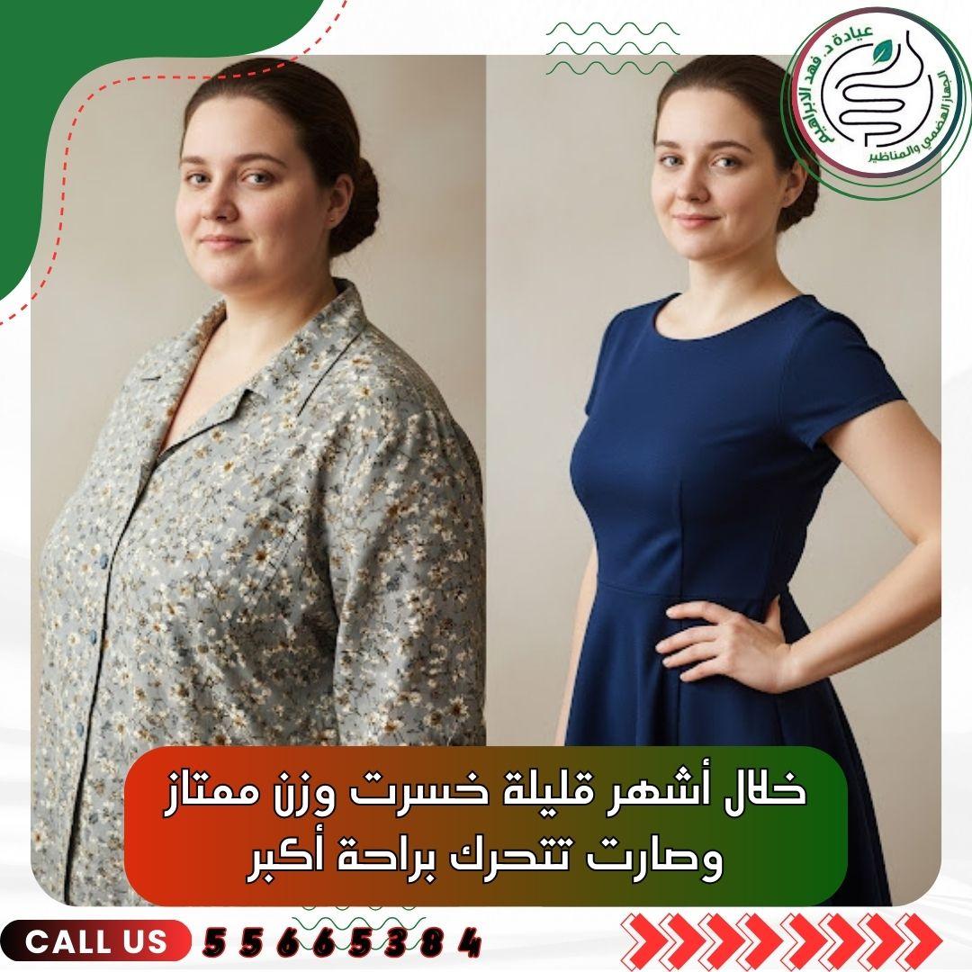 بالون المعدة مع د. فهد الإبراهيم – أفضل علاج للسمنة بالكويت