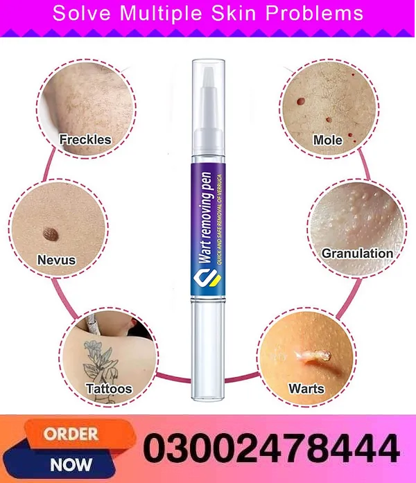 Wart Removing Pen In Pakistan- 03002478444