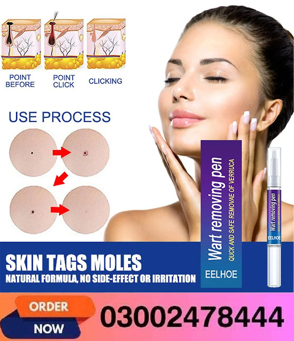 Wart Removing Pen In Pakistan- 03002478444