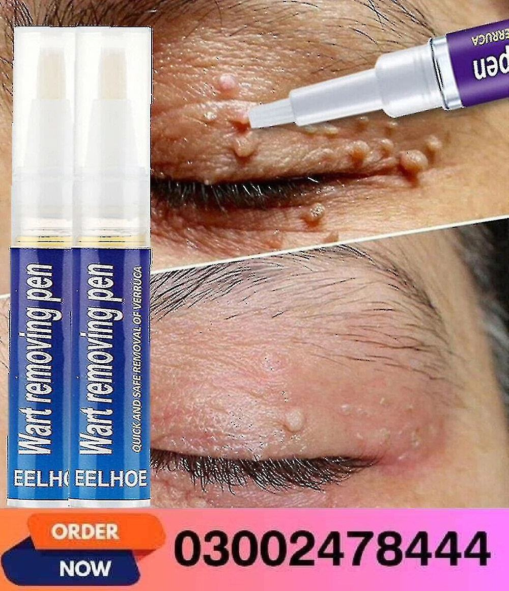 Wart Removing Pen In Pakistan- 03002478444