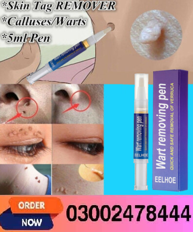 Wart Removing Pen In Pakistan- 03002478444