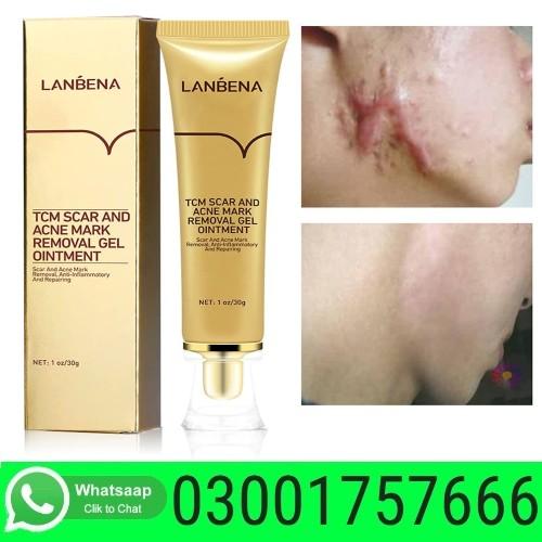 Buy Akary Acne Scar Removal Cream in Pakistan - 03001757666
