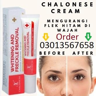 Chalonese Brightening Cream in Pakistan | 03013567658 Buy Orignal