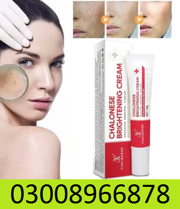 Chalonese Brightening Cream In Pakistan - 0300*8966878