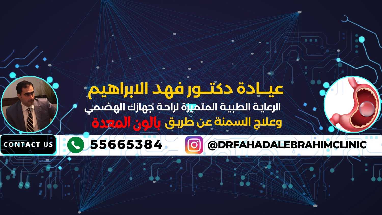 بالون المعدة مع أفضل دكتور بالكويت فهد_الإبراهيم