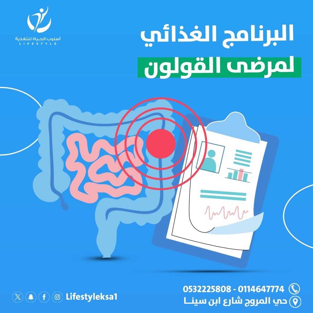 مركز اسلوب الحياة للتغذية العلاجية