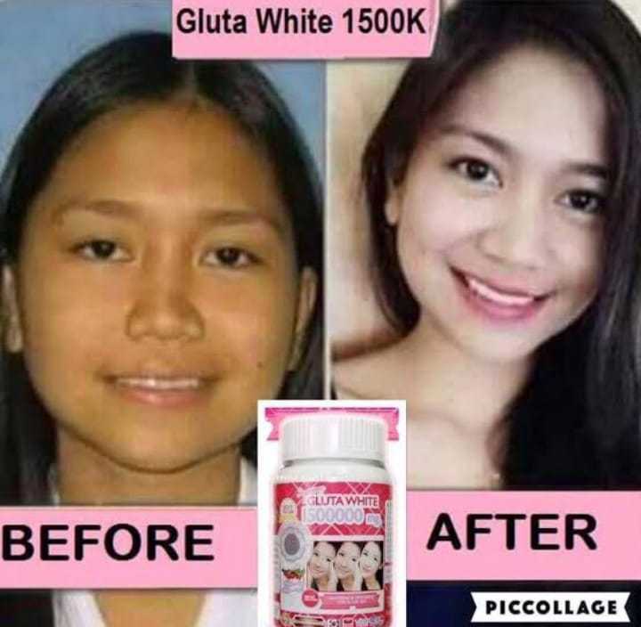 حبوب التبييض جلوتا وايت Gluta White 1500000 m 01023678560