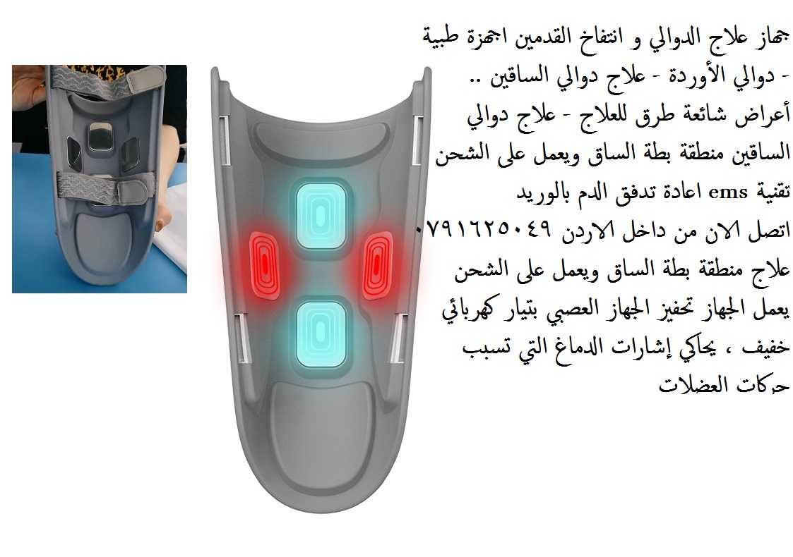 اجهزة طبية طرق علاج الدوالي للساقين | علاج دوالي الساقين | 2022 جهاز #