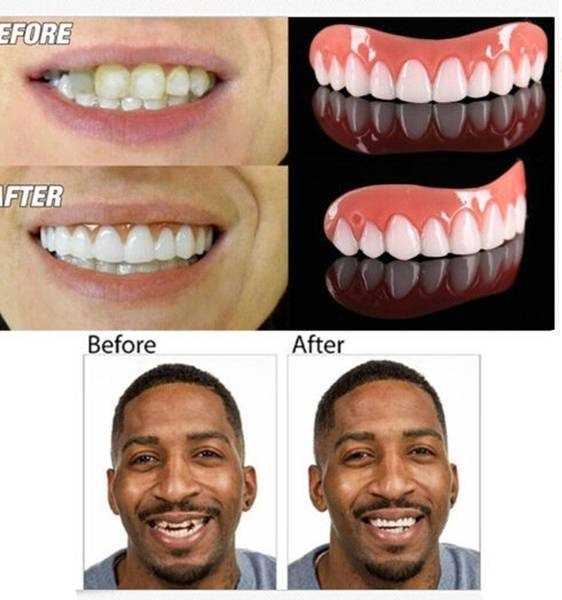 طقم اسنان مؤقت perfect smile ابتسامة هوليود مع منتج بيرفكت سمايل اسنان